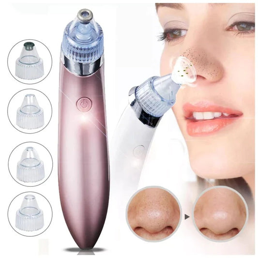 Glow Skin™ Extractor De Puntos Negros Y Espinillas